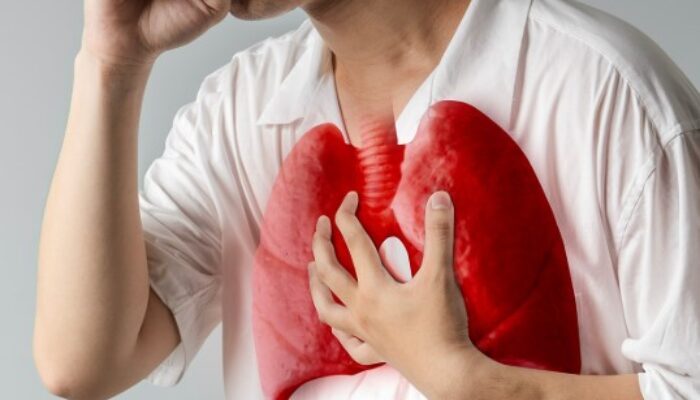 Penyakit TBC di Samarinda Meningkat, Pemkot Percepat Deteksi dengan Skrining Cepat