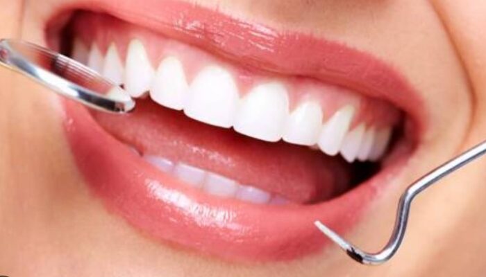 Cara Menjaga Kesehatan Gigi dan Mulut untuk Mencegah Masalah Kesehatan Serius