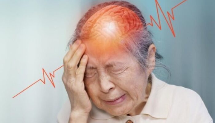 dr. Zaidul Akbar Ungkap Kunci Sehat Terhindar dari Stroke, Bukan Hanya Soal Medis